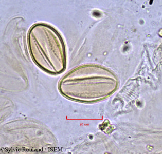 Sylvie.Rouland/Caylusea_hexagyna_748/Caylusea_hexagyna_748_0001(copy)_thumb.jpg