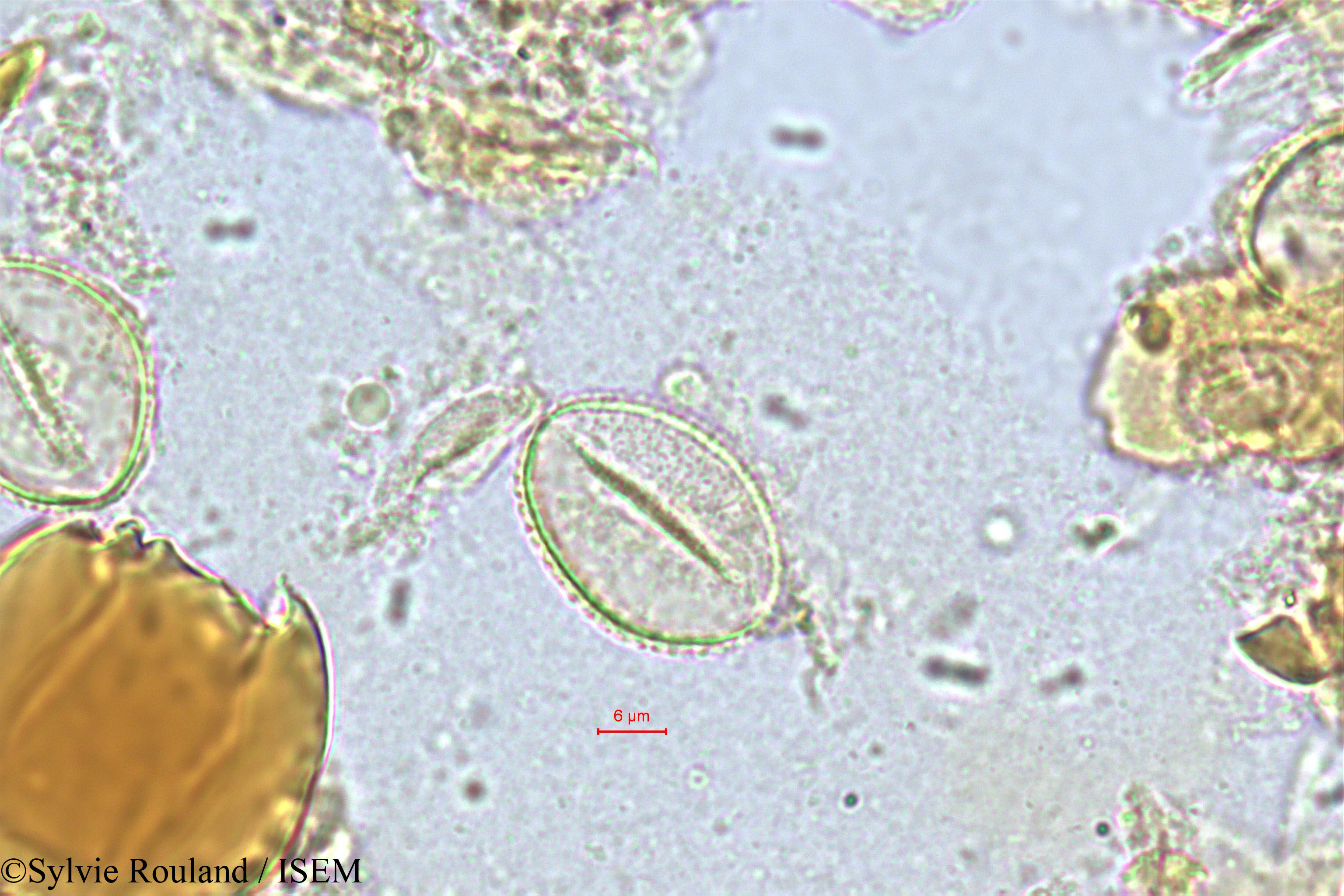 Sylvie.Rouland/Chrysalidocarpus_fibrosus_352/Chrysalidocarpus_fibrosus_352_0001(copy).jpg