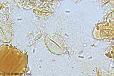 Sylvie.Rouland/Chrysalidocarpus_fibrosus_352/Chrysalidocarpus_fibrosus_352_0001(copy)_thumb.jpg