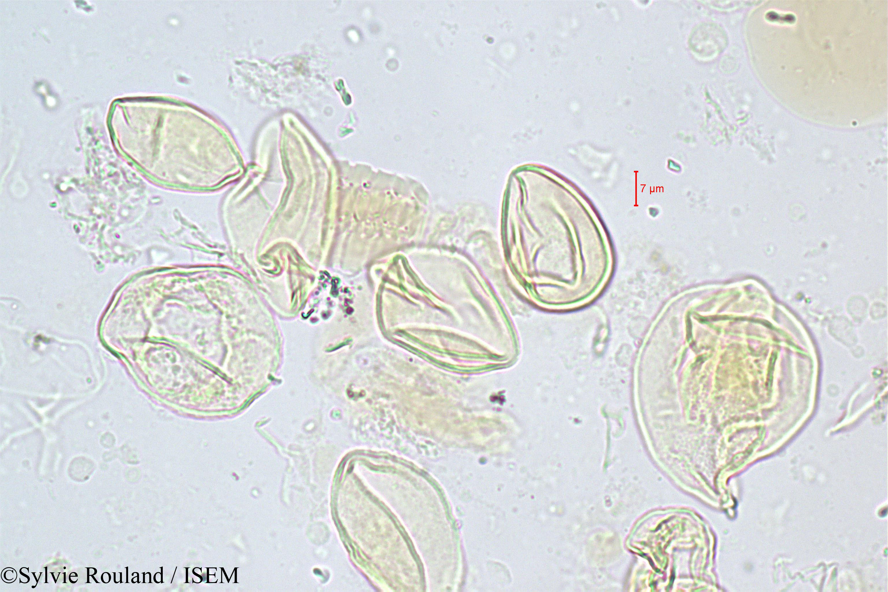 Sylvie.Rouland/Chrysalidocarpus_mananjarensis_347/Chrysalidocarpus_mananjarensis_347_0004(copy).jpg