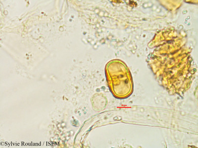 Chrysophyllum boivinianum - lame n° 1478
