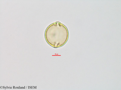 Sylvie.Rouland/Cliffortia_cuneata_29469/Cliffortia_cuneata_29469_0001(copy)_thumb.jpg