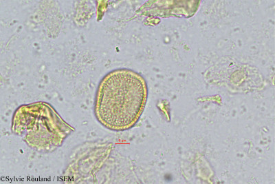 Coelocaryon klainei - lame n° 237