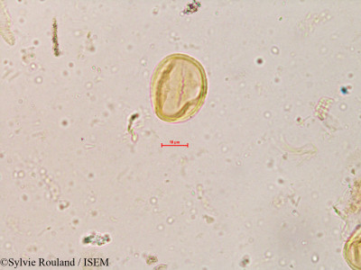 Sylvie.Rouland/Dalbergia_congesta_3988/Dalbergia_congesta_3988_0001(copy)_thumb.jpg