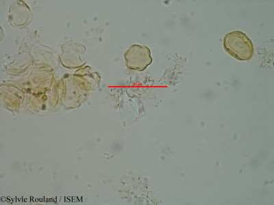 Sylvie.Rouland/Dichaetanthera_ciliata_1493/Dichaetanthera_ciliata_1493_0001(copy)_thumb.jpg