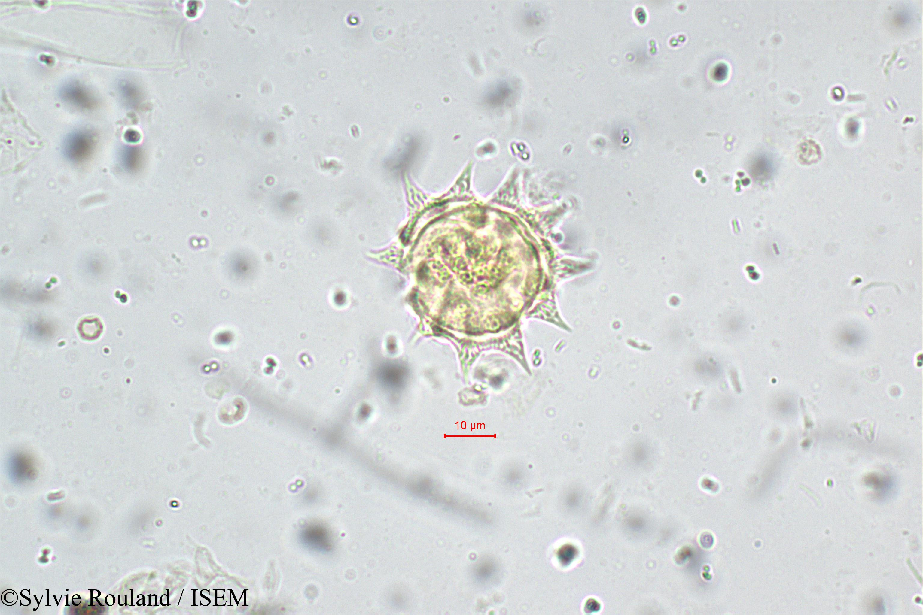 Sylvie.Rouland/Epaltes_divaricata_5550/Epaltes_divaricata_5550_0001(copy).jpg