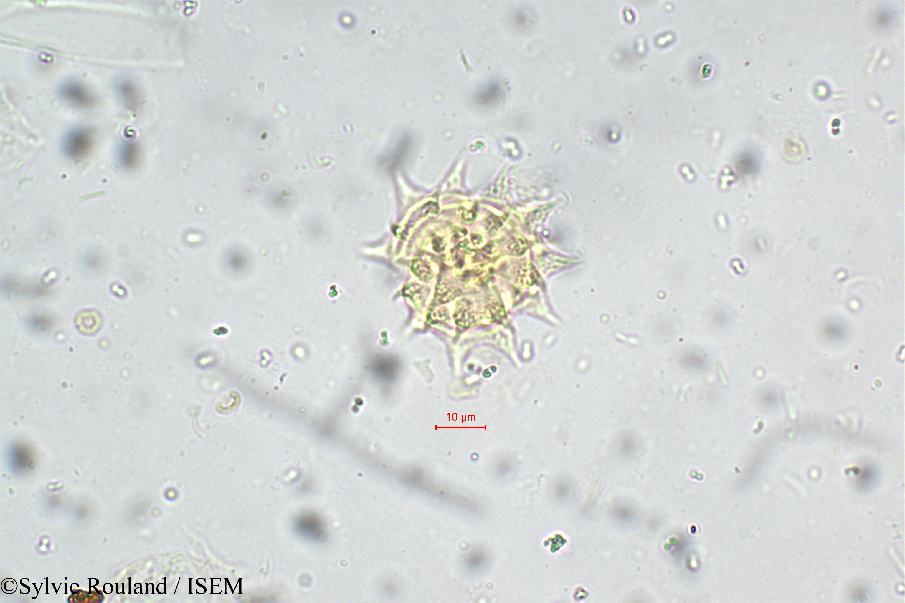 Sylvie.Rouland/Epaltes_divaricata_5550/Epaltes_divaricata_5550_0002(copy).jpg