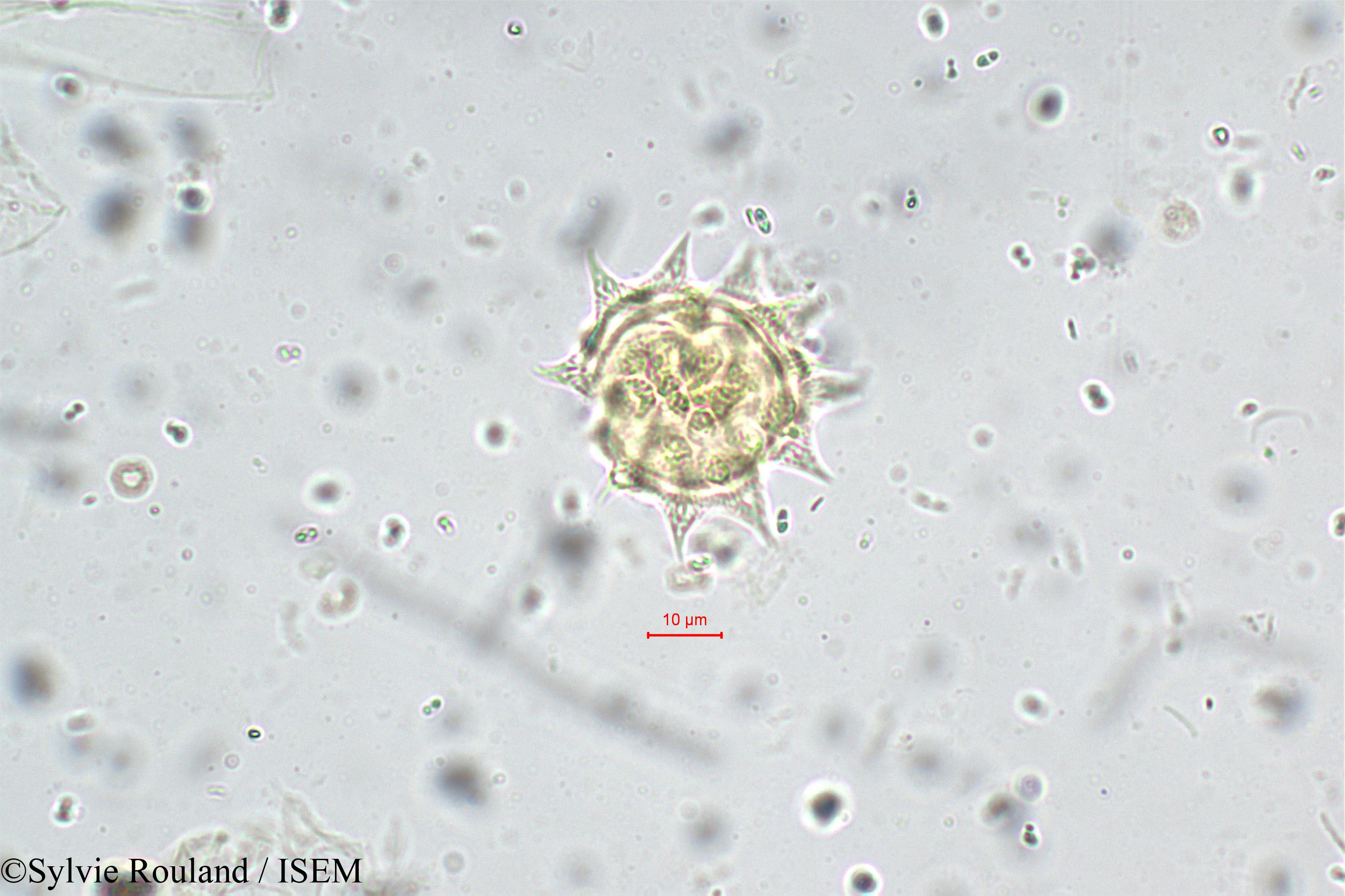 Sylvie.Rouland/Epaltes_divaricata_5550/Epaltes_divaricata_5550_0003(copy).jpg
