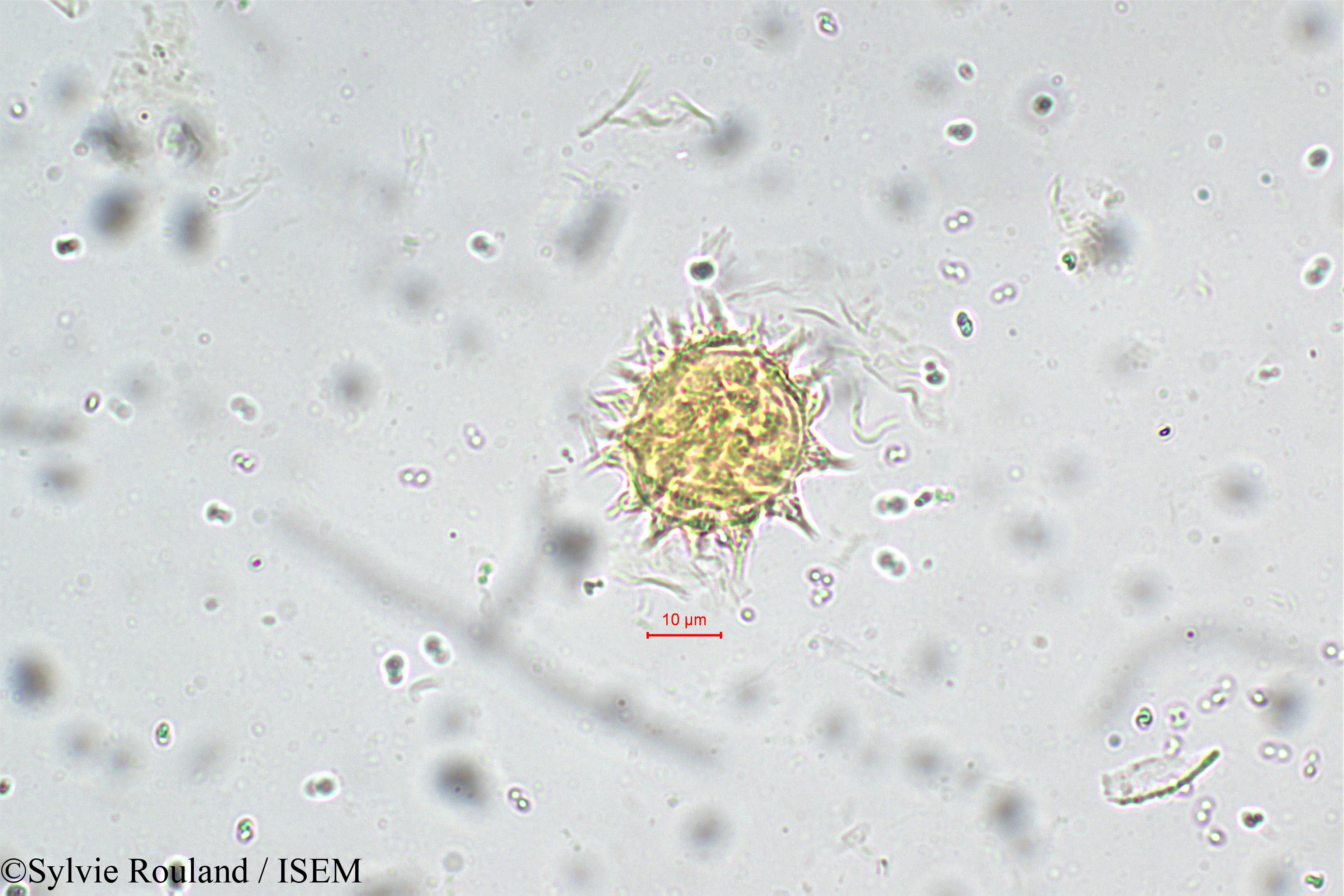 Sylvie.Rouland/Epaltes_divaricata_5550/Epaltes_divaricata_5550_0004(copy).jpg