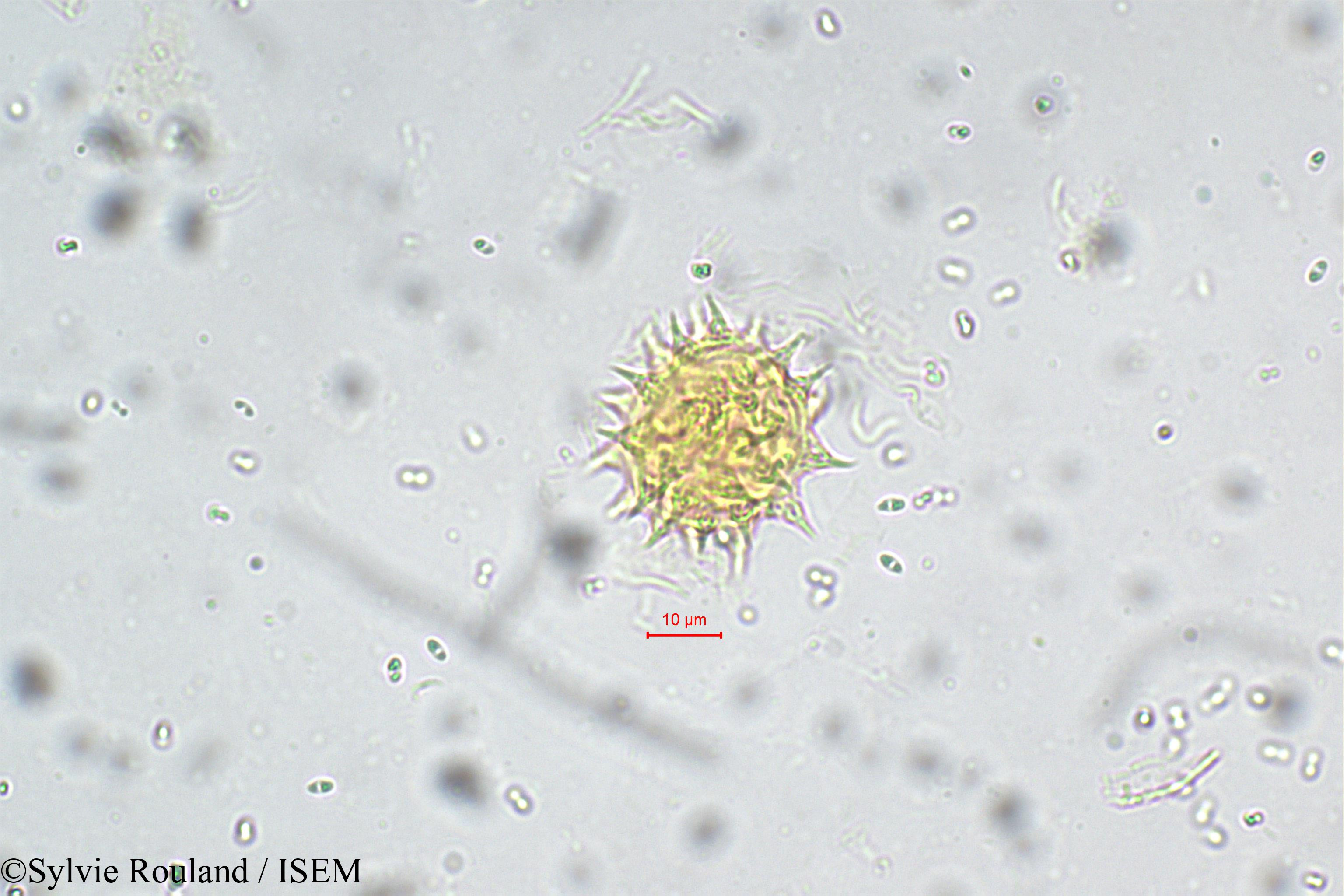 Sylvie.Rouland/Epaltes_divaricata_5550/Epaltes_divaricata_5550_0005(copy).jpg