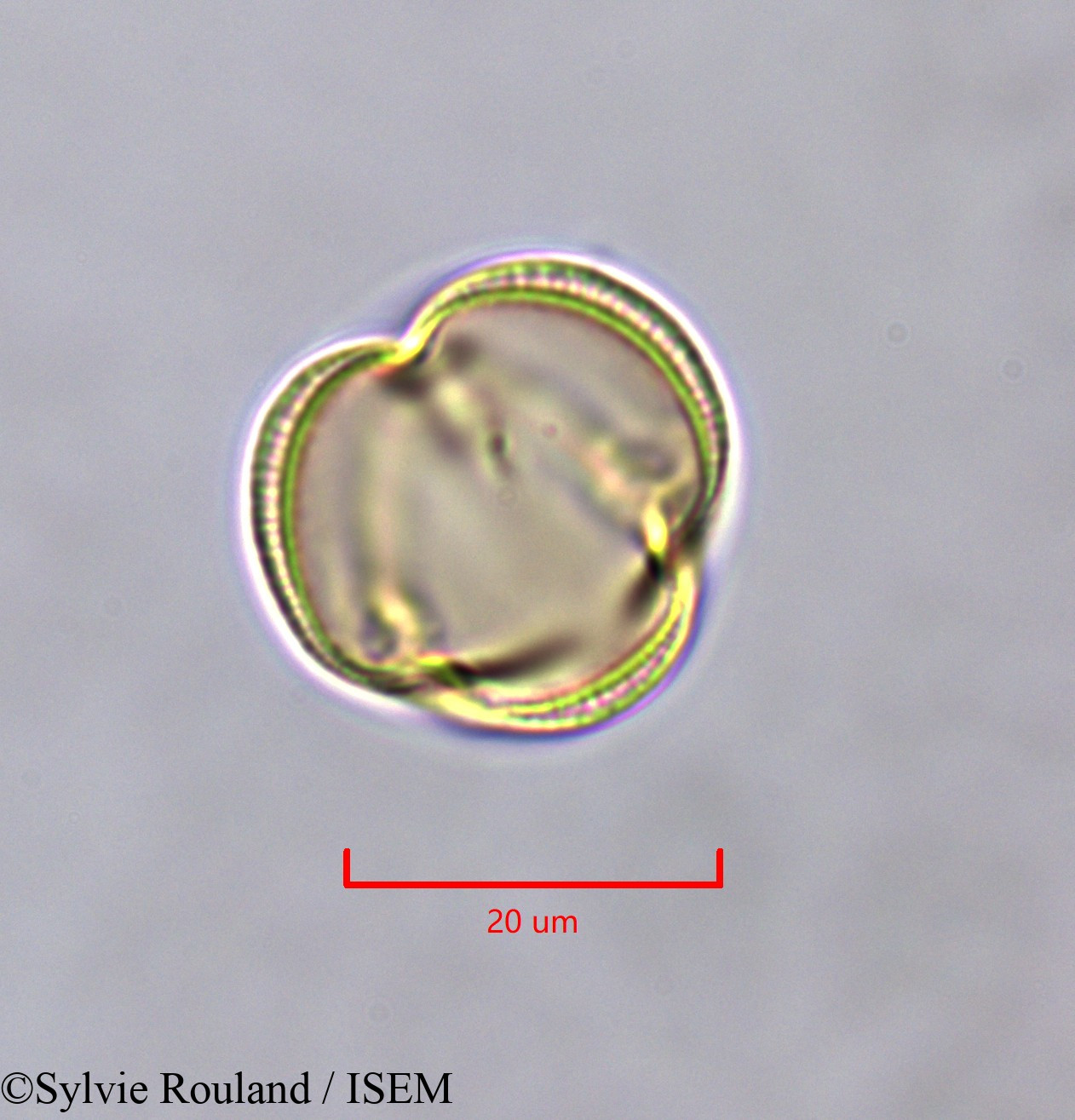 Sylvie.Rouland/Erythrophleum_ivorense_47366/Erythrophleum_ivorense_47366_0001(copy).jpg