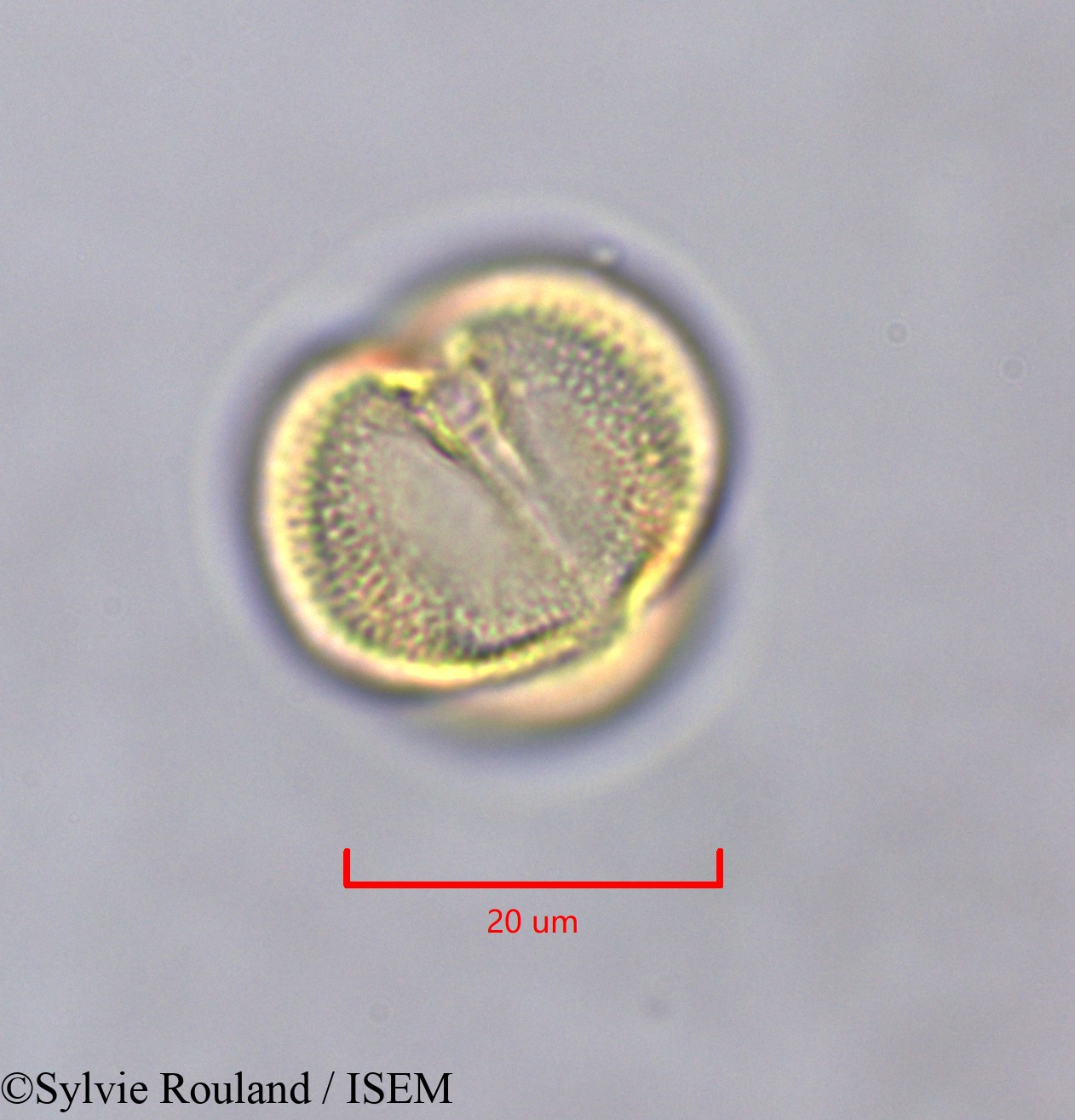 Sylvie.Rouland/Erythrophleum_ivorense_47366/Erythrophleum_ivorense_47366_0003(copy).jpg