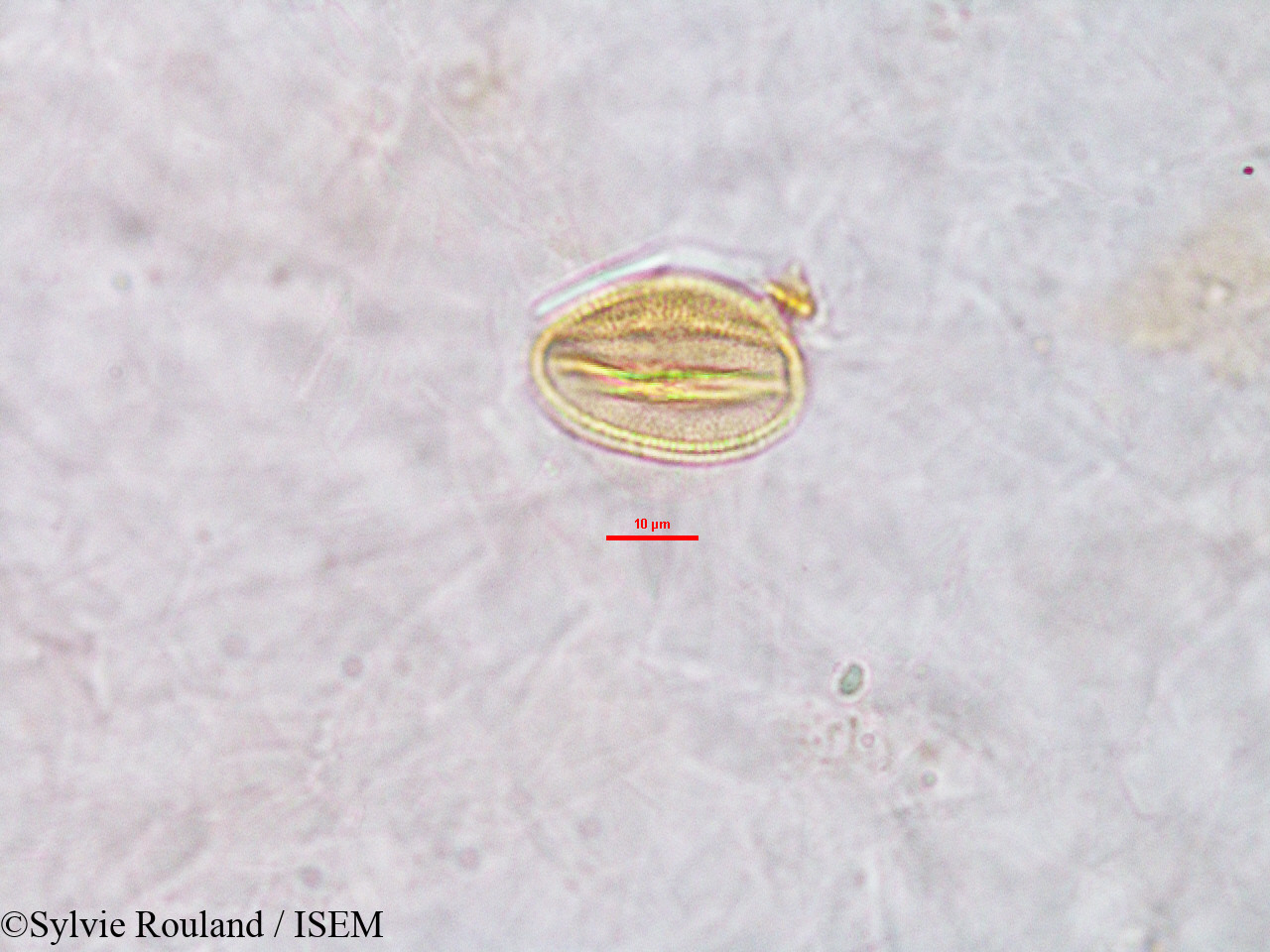 Sylvie.Rouland/Erythrophleum_sp._2773/Erythrophleum_sp._2773_0001(copy).jpg