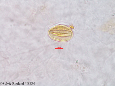 Sylvie.Rouland/Erythrophleum_sp._2773/Erythrophleum_sp._2773_0001(copy)_thumb.jpg