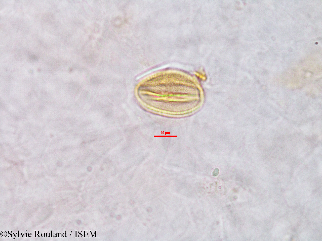 Sylvie.Rouland/Erythrophleum_sp._2773/Erythrophleum_sp._2773_0003(copy).jpg
