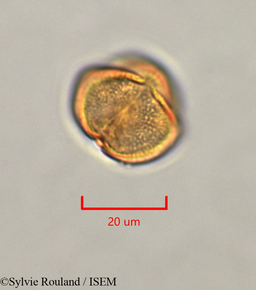 Sylvie.Rouland/Erythrophleum_suaveolens_47336/Erythrophleum_suaveolens_47336_0002(copy).jpg