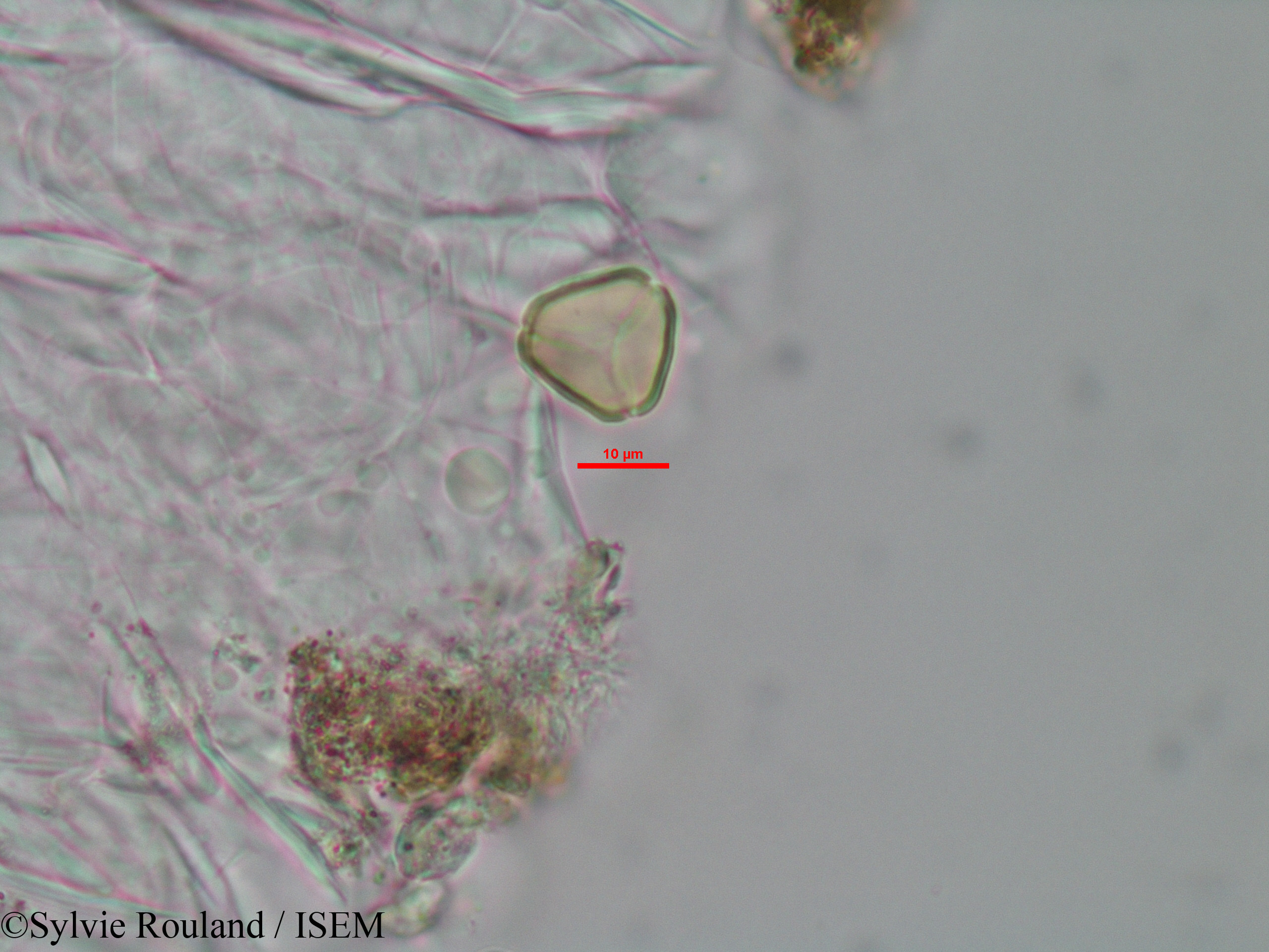 Sylvie.Rouland/Eugenia_micropoda_3445/Eugenia_micropoda_3445_0002(copy).jpg