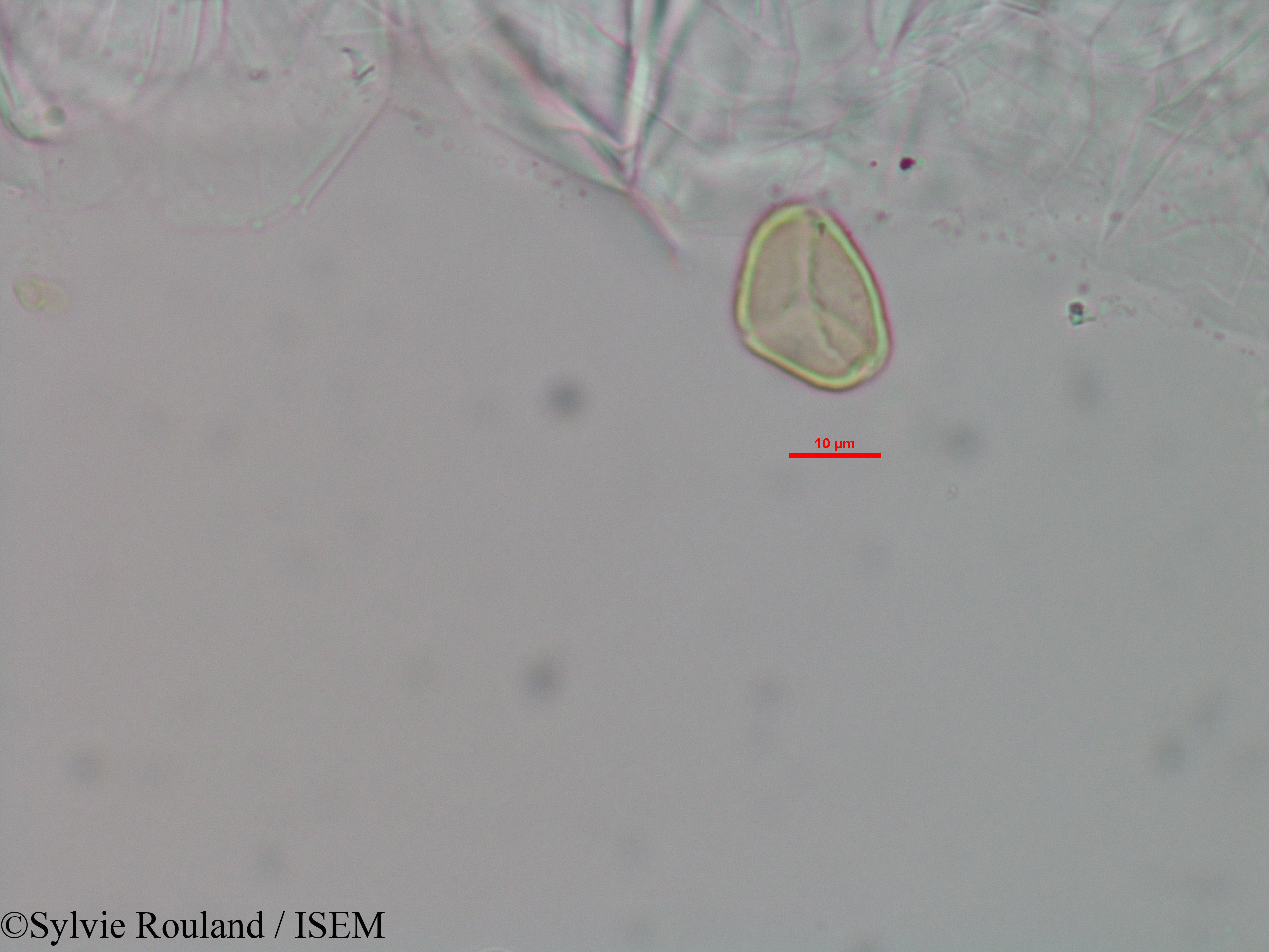 Sylvie.Rouland/Eugenia_micropoda_3445/Eugenia_micropoda_3445_0004(copy).jpg