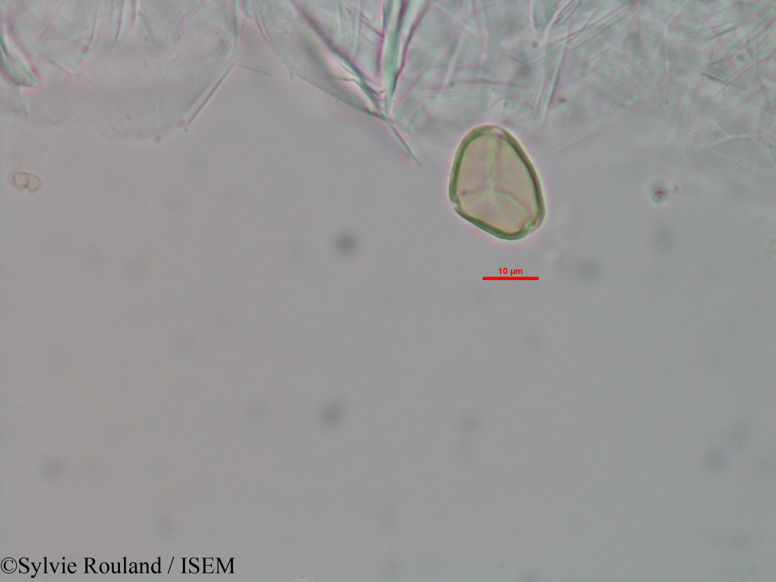 Sylvie.Rouland/Eugenia_micropoda_3445/Eugenia_micropoda_3445_0005(copy).jpg