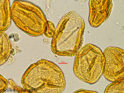 Sylvie.Rouland/Grewia_bicolor_21250/Grewia_bicolor_21250_0001(copy)_thumb.jpg