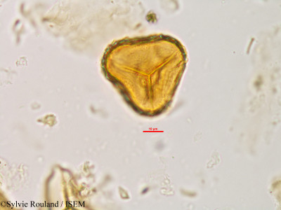 Sylvie.Rouland/Gymnosphaera_madagascarica_81055/Gymnosphaera_madagascarica_81055_0001(copy)_thumb.jpg