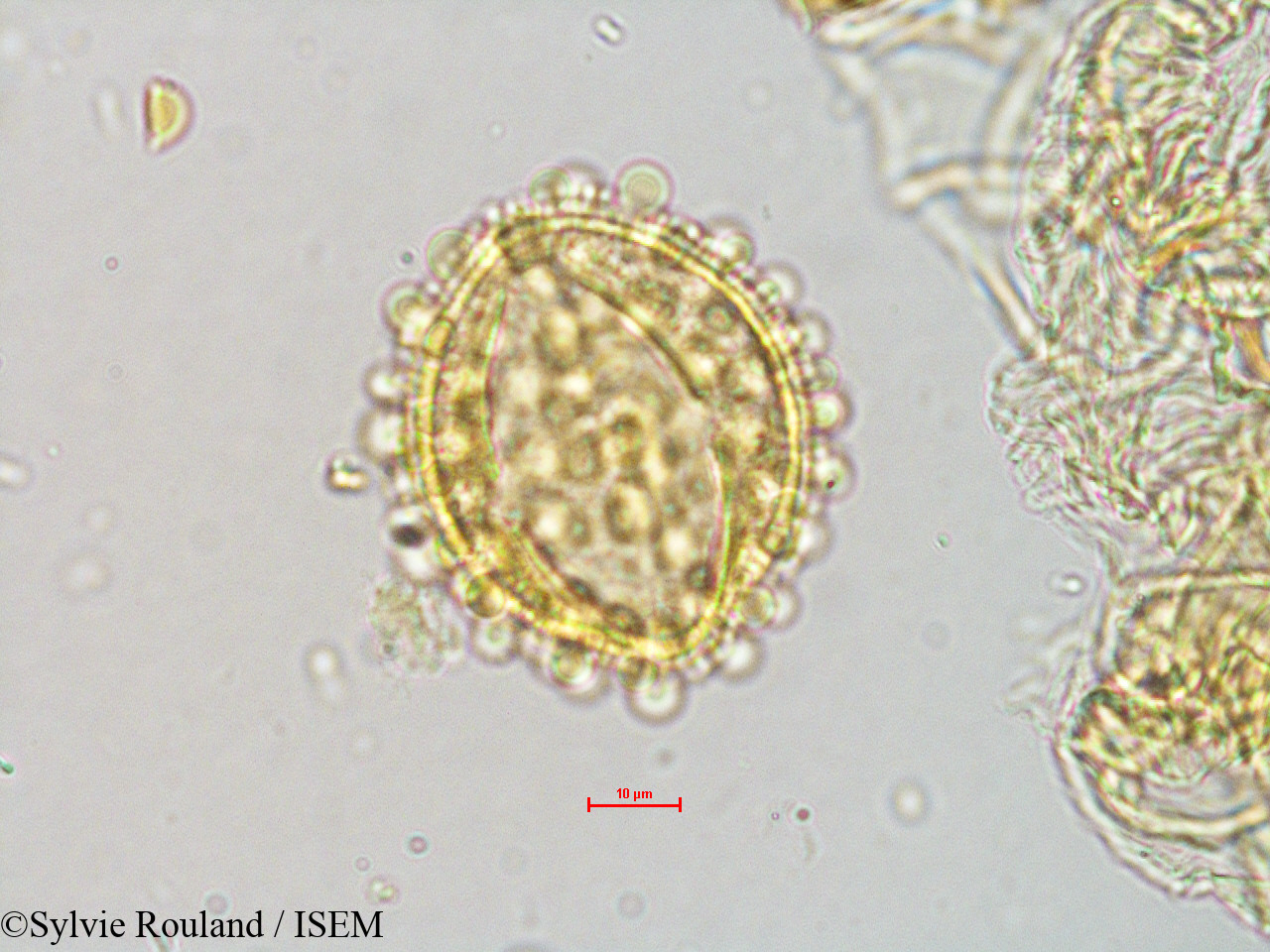 Sylvie.Rouland/Gynocardia_odorata_4072/Gynocardia_odorata_4072_0003(copy).jpg