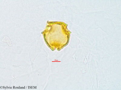 Sylvie.Rouland/Hymenocnemis_madagascariensis_3198/Hymenocnemis_madagascariensis_3198_0001(copy)_thumb.jpg