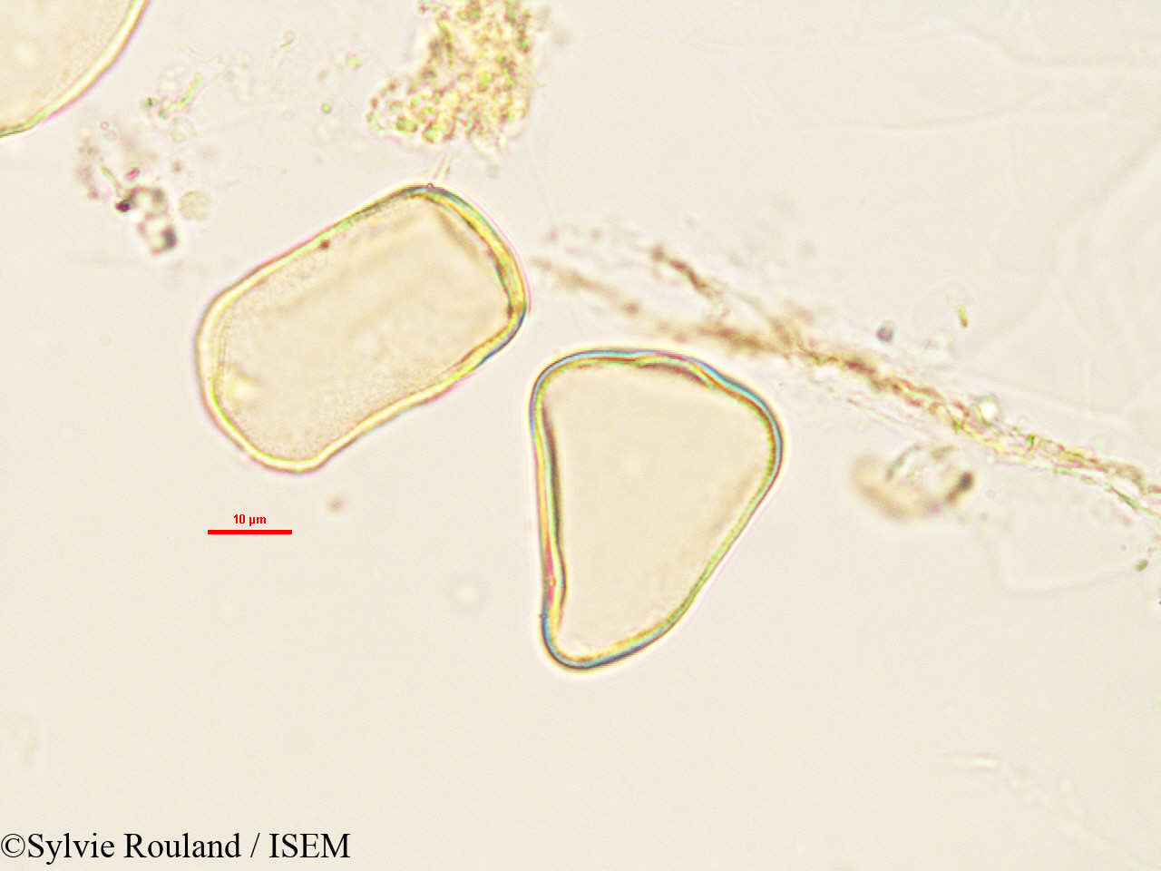 Sylvie.Rouland/Lepironia_mucronata_2986/Lepironia_mucronata_2986_0005(copy).jpg