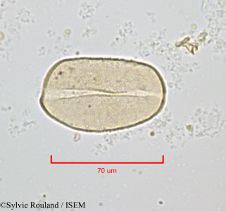 Sylvie.Rouland/Lomatophyllum_antsingyense_1246/Lomatophyllum_antsingyense_1246_0001(copy)_thumb.jpg
