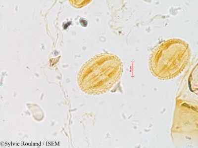 Sylvie.Rouland/Meliosma_yunnanensis_4040/Meliosma_yunnanensis_4040_0001(copy)_thumb.jpg