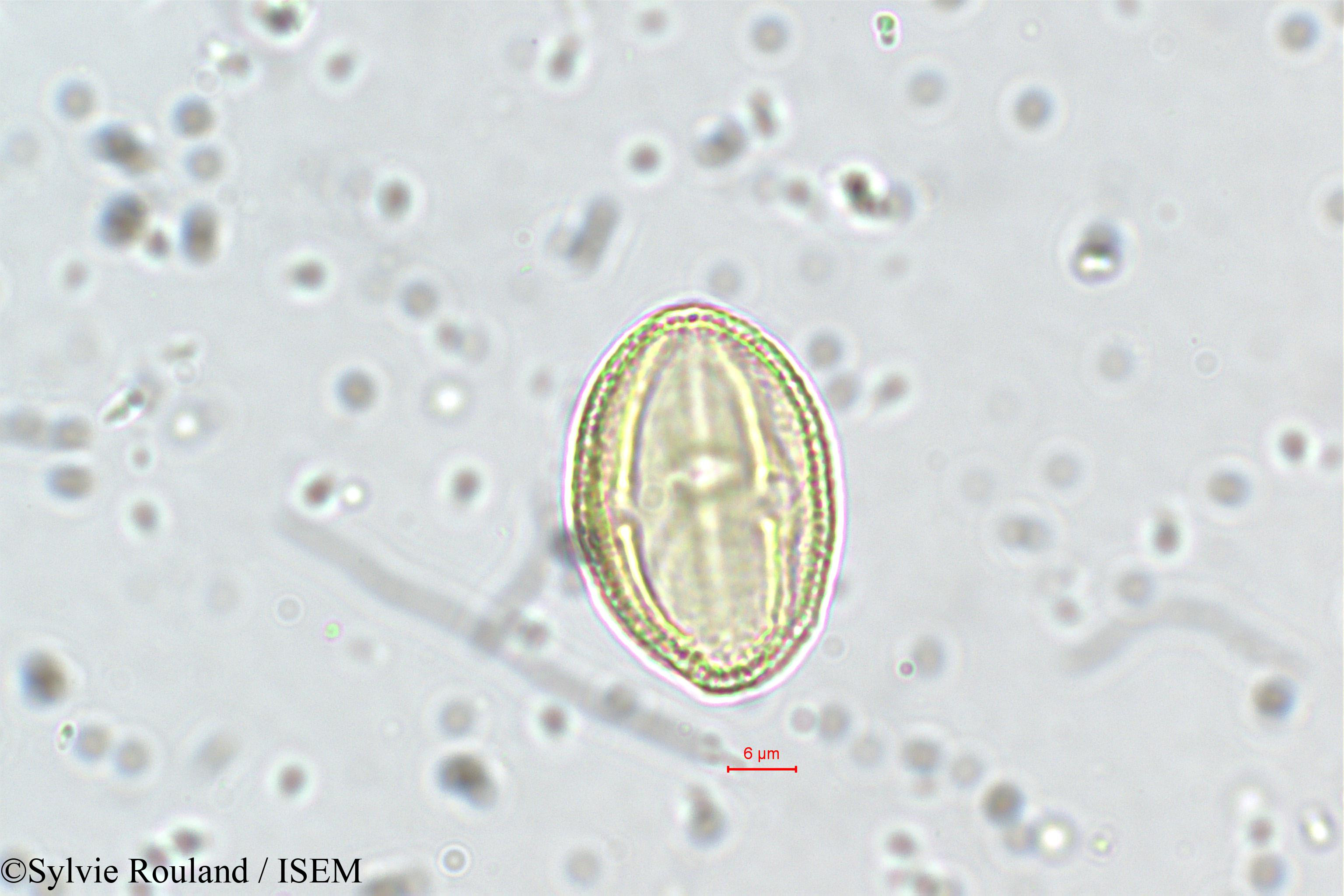 Sylvie.Rouland/Neopeltandra_suberosa_5635/Neopeltandra_suberosa_5635_0001(copy).jpg