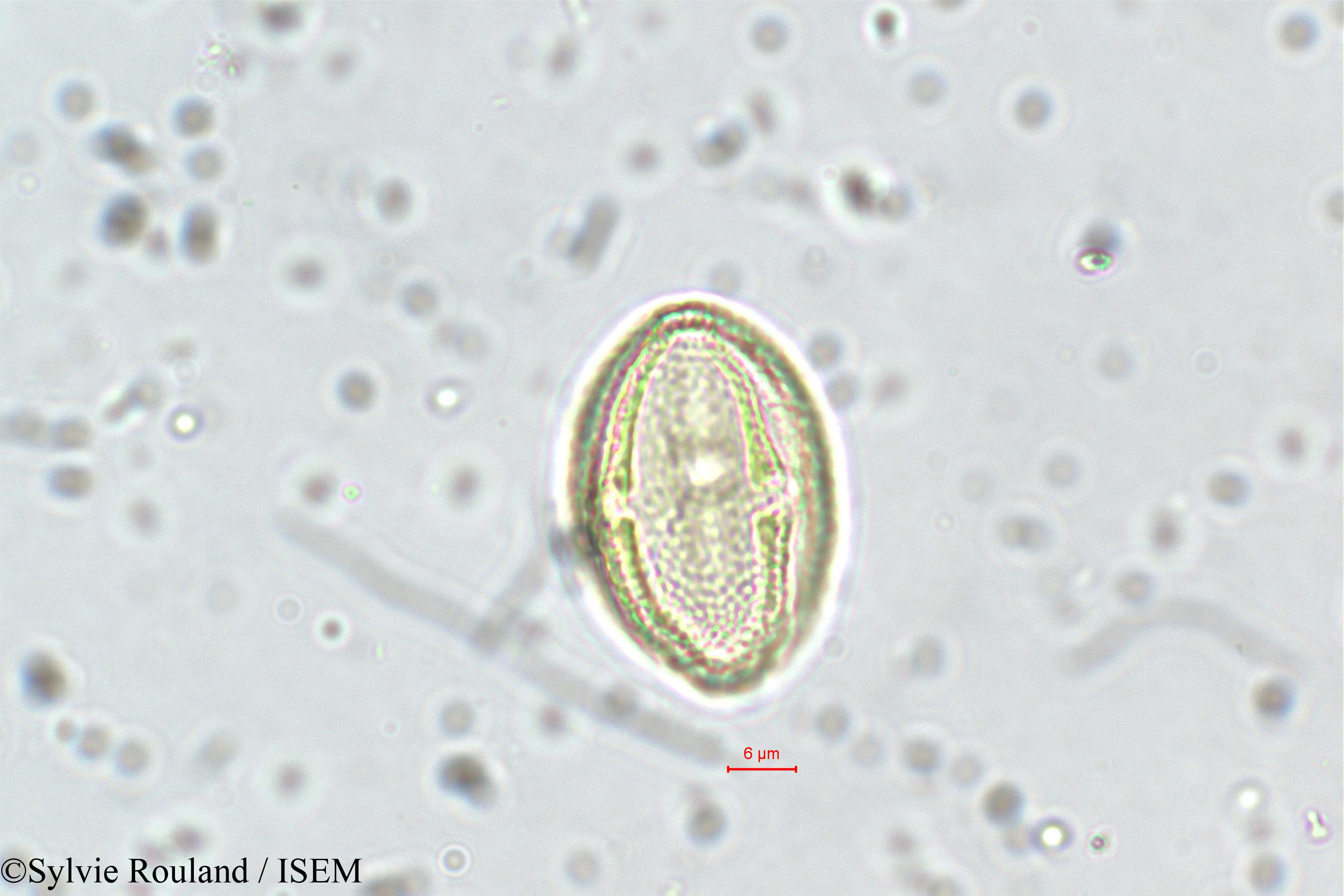 Sylvie.Rouland/Neopeltandra_suberosa_5635/Neopeltandra_suberosa_5635_0002(copy).jpg