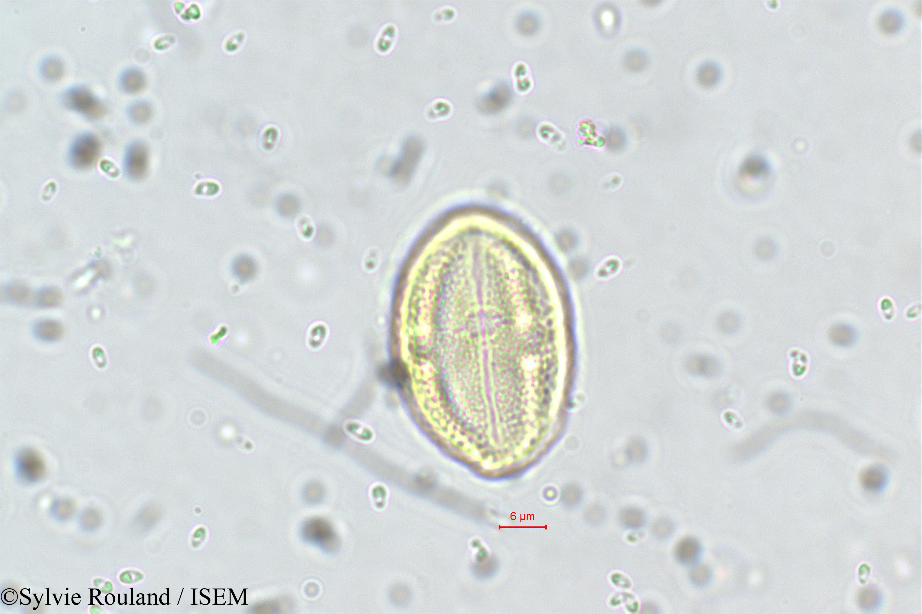 Sylvie.Rouland/Neopeltandra_suberosa_5635/Neopeltandra_suberosa_5635_0003(copy).jpg