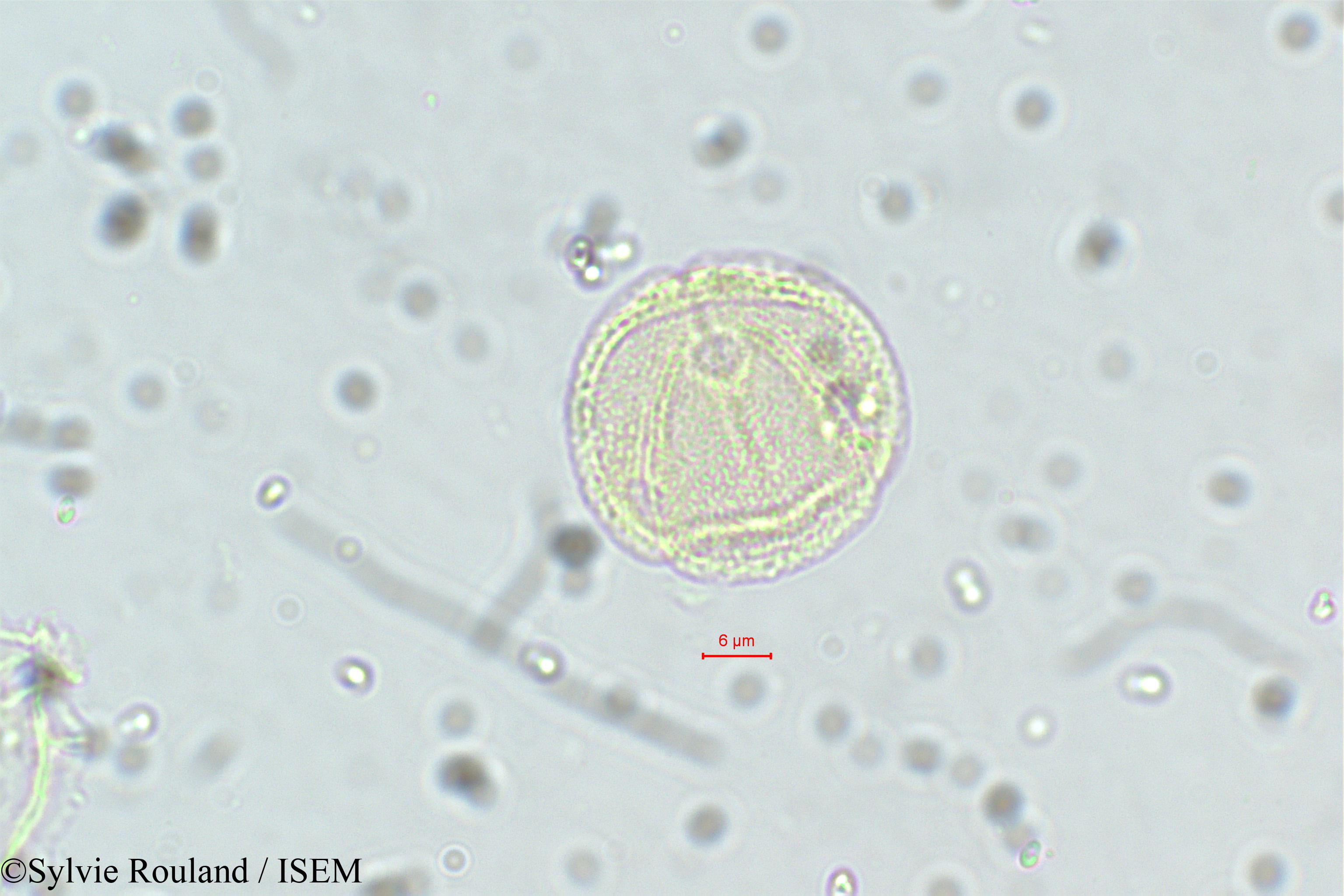 Sylvie.Rouland/Neopeltandra_suberosa_5635/Neopeltandra_suberosa_5635_0004(copy).jpg