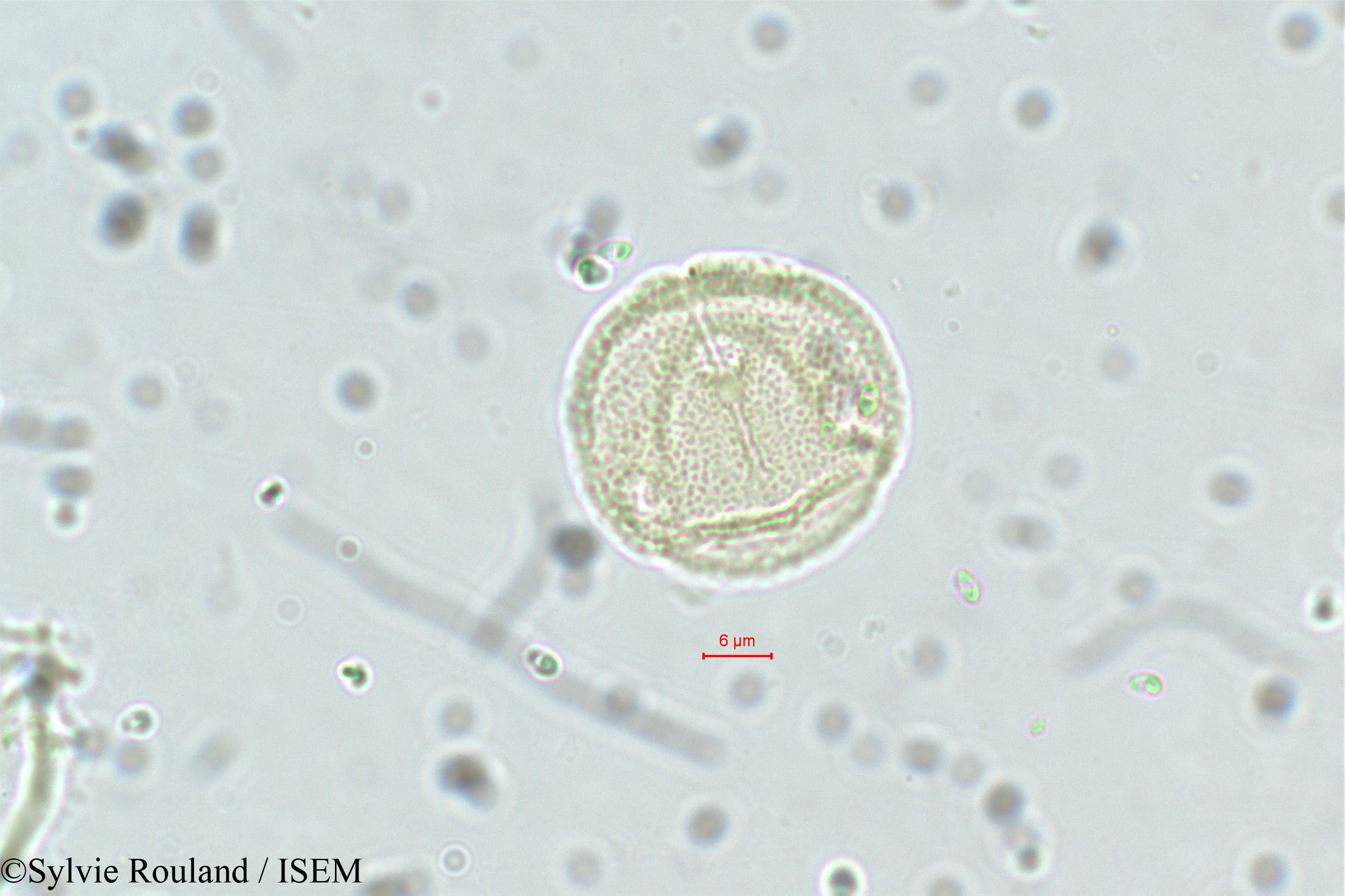 Sylvie.Rouland/Neopeltandra_suberosa_5635/Neopeltandra_suberosa_5635_0005(copy).jpg