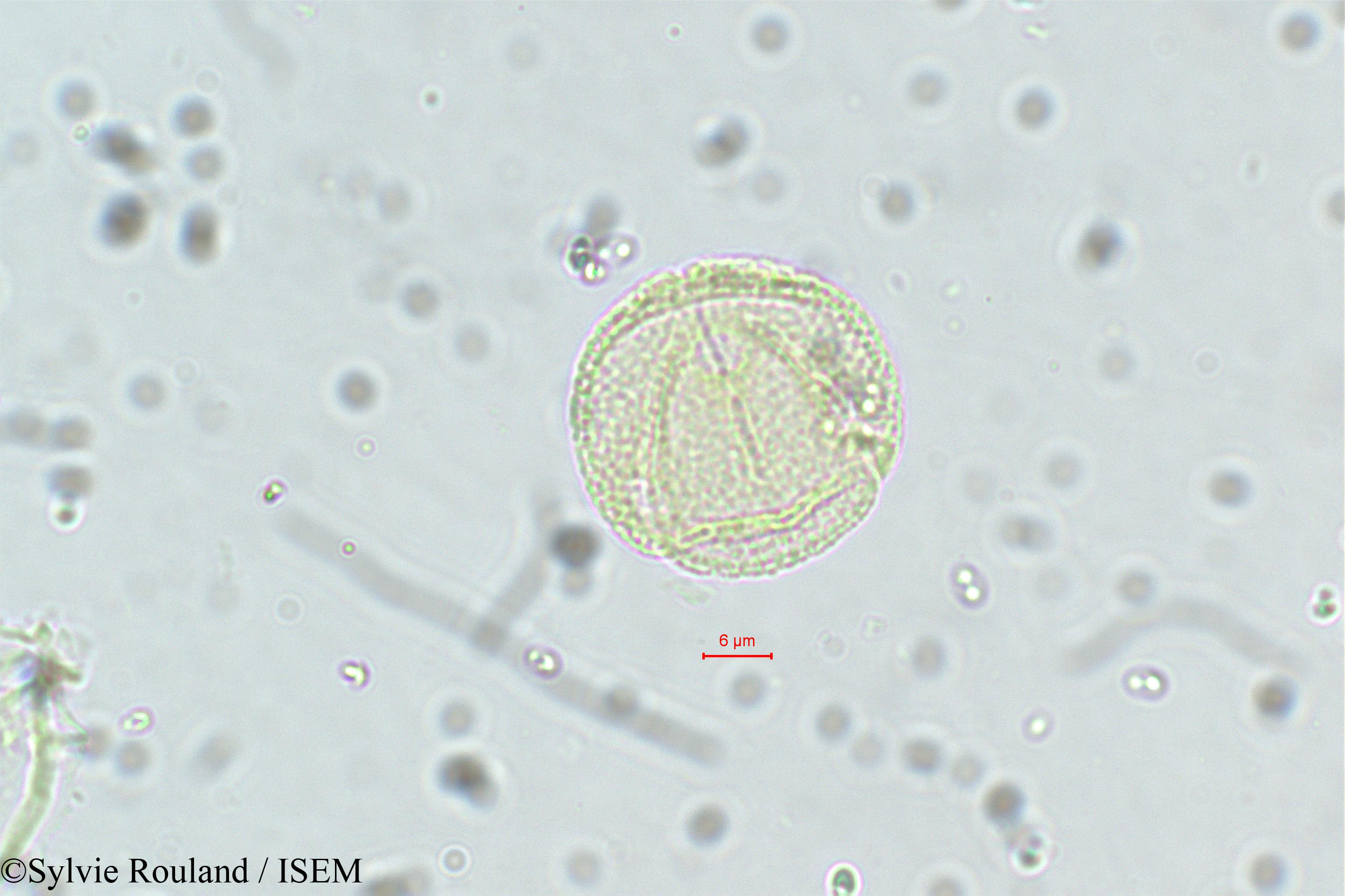 Sylvie.Rouland/Neopeltandra_suberosa_5635/Neopeltandra_suberosa_5635_0006(copy).jpg