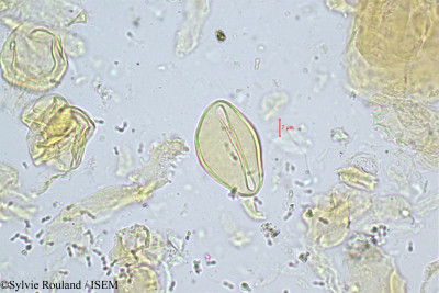 Sylvie.Rouland/Neophloga_mananjarensis_322/Neophloga_mananjarensis_322_0001(copy)_thumb.jpg