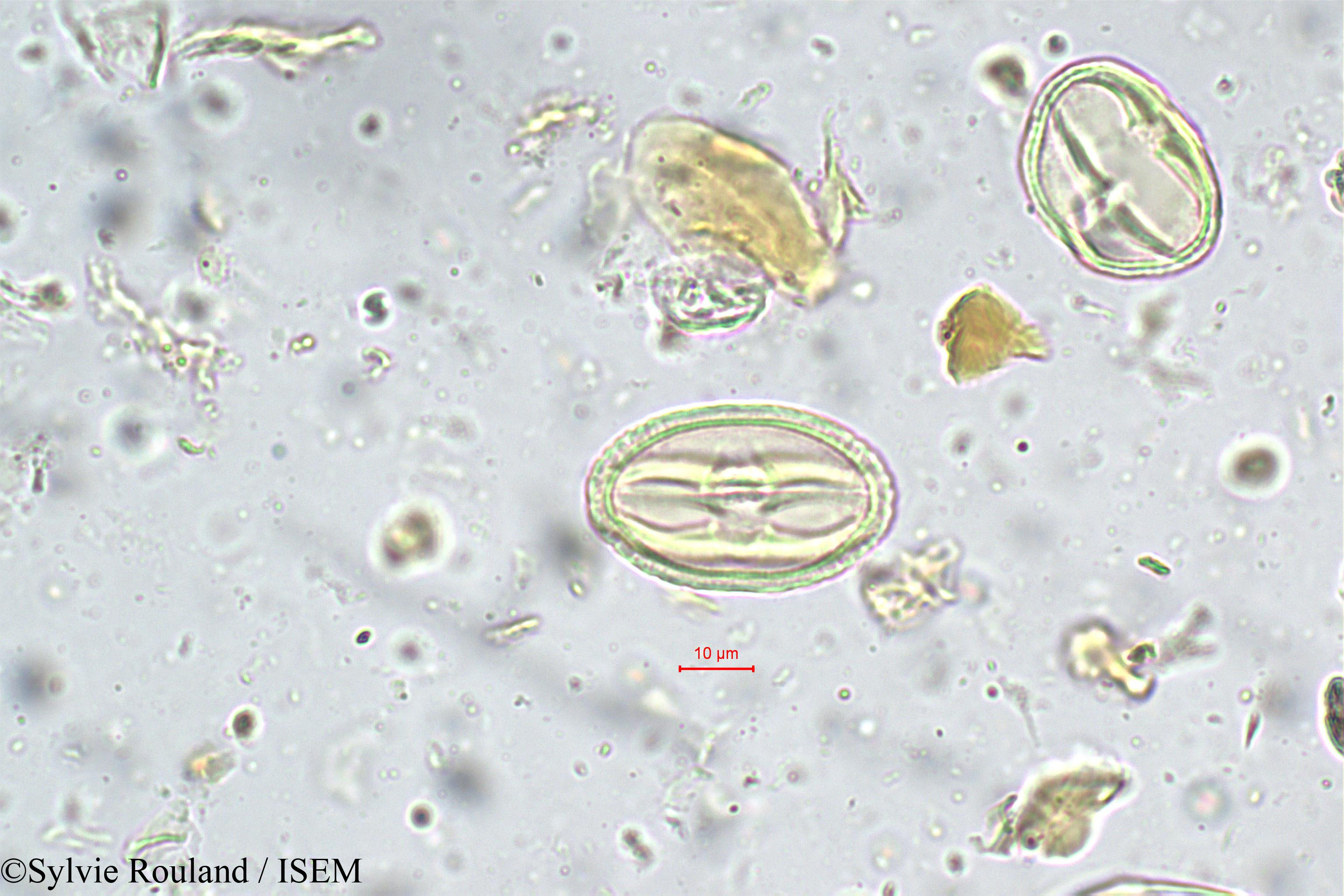 Sylvie.Rouland/Nothopegia_heyneana_5666/Nothopegia_heyneana_5666_0001(copy).jpg