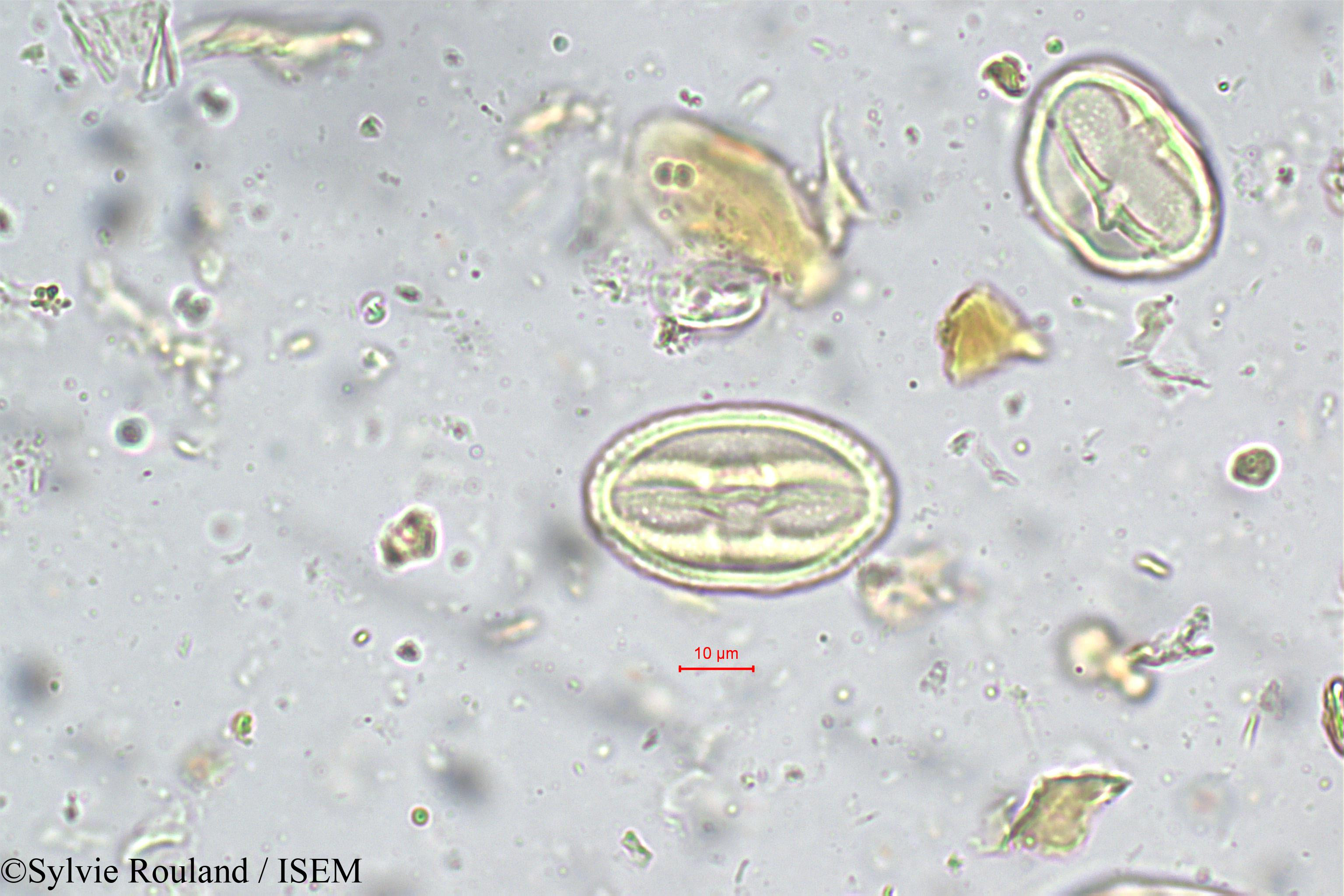 Sylvie.Rouland/Nothopegia_heyneana_5666/Nothopegia_heyneana_5666_0002(copy).jpg