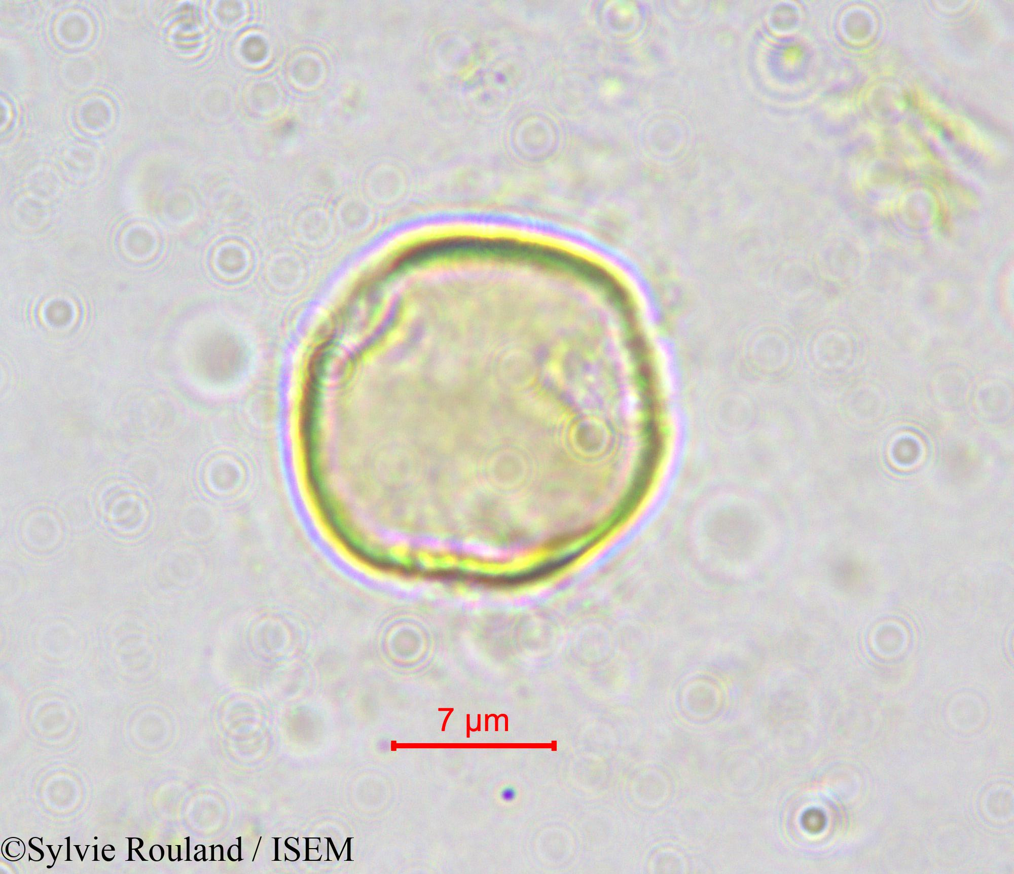 Sylvie.Rouland/Octoknema_klaineana_562/Octoknema_klaineana_562_0005(copy).jpg