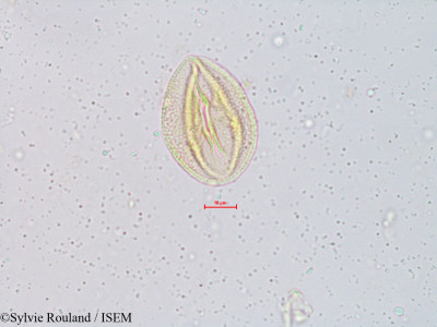 Sylvie.Rouland/Pavetta_breviflora_4909/Pavetta_breviflora_4909_0001(copy)_thumb.jpg