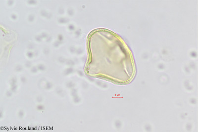 Sylvie.Rouland/Pleurospermum_austriacum_426/Pleurospermum_austriacum_426_0001(copy)_thumb.jpg