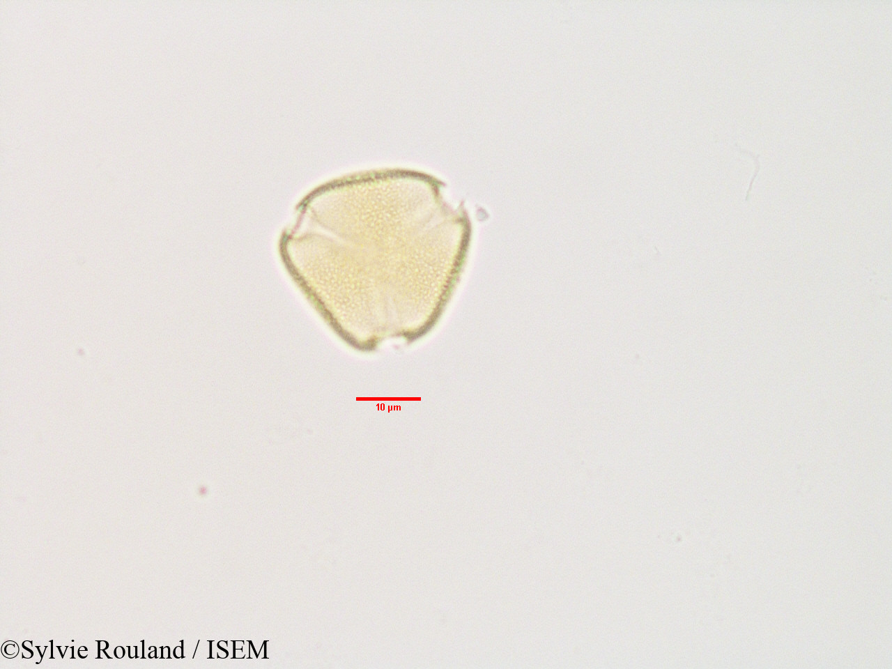Sylvie.Rouland/Poculodiscus_meridionalis_3366/Poculodiscus_meridionalis_3366_0005(copy).jpg