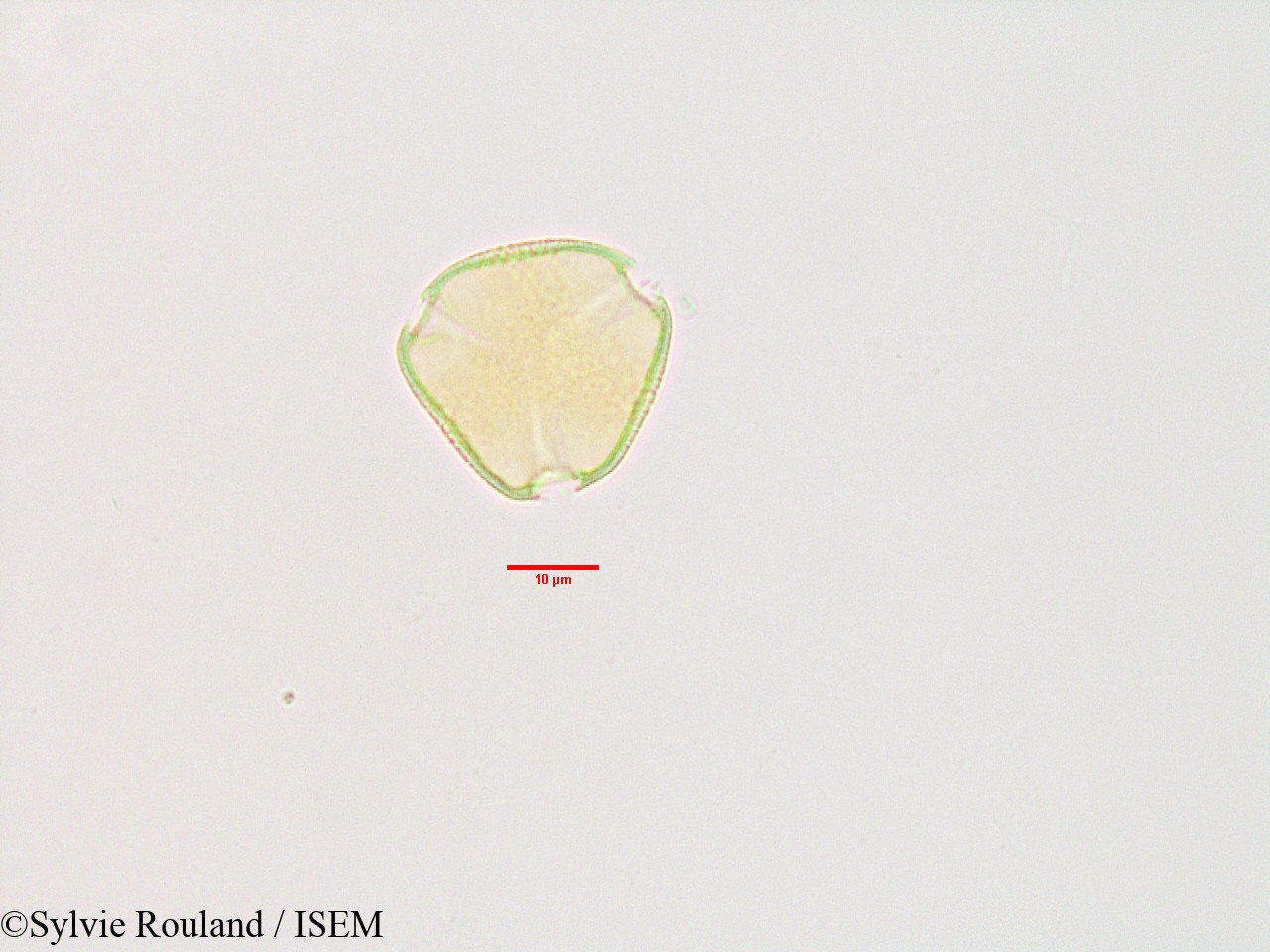 Sylvie.Rouland/Poculodiscus_meridionalis_3366/Poculodiscus_meridionalis_3366_0007(copy).jpg