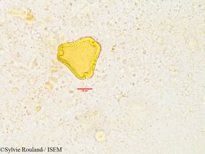 Sylvie.Rouland/Poculodiscus_sambiranensis_3367/Poculodiscus_sambiranensis_3367_0001(copy)_thumb.jpg