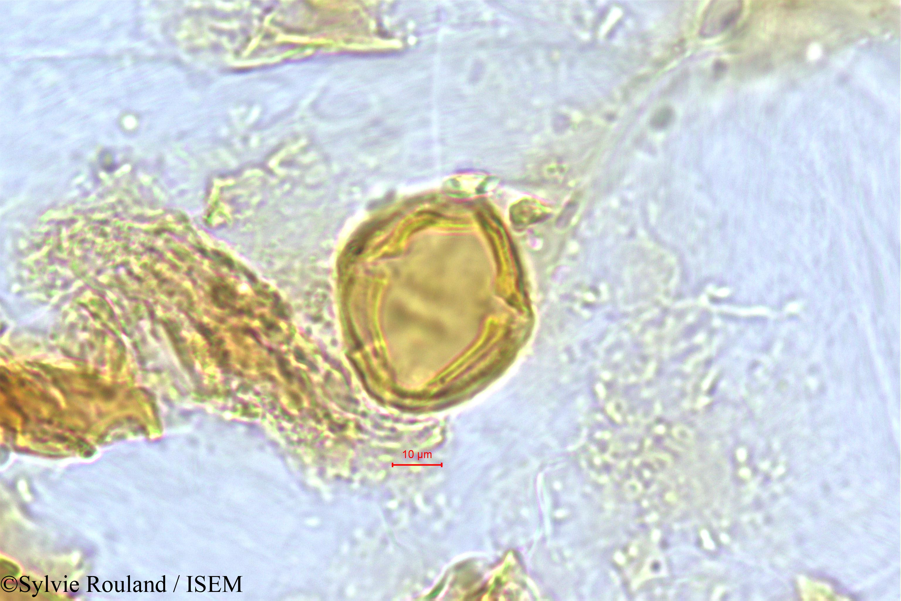 Sylvie.Rouland/Protorhus_sericea_504/Protorhus_sericea_504_0005(copy).jpg