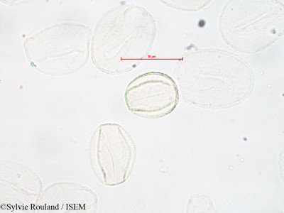 Sylvie.Rouland/Quercus_sessilis_4150/Quercus_sessilis_4150_0001(copy)_thumb.jpg