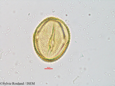 Sylvie.Rouland/Raphidiocystis_brachypoda_3258/Raphidiocystis_brachypoda_3258_0001(copy)_thumb.jpg