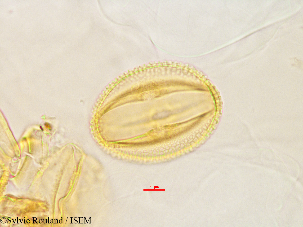 Sylvie.Rouland/Raphidocystis_sakalavensis_2846/Raphidocystis_sakalavensis_2846_0002(copy).jpg