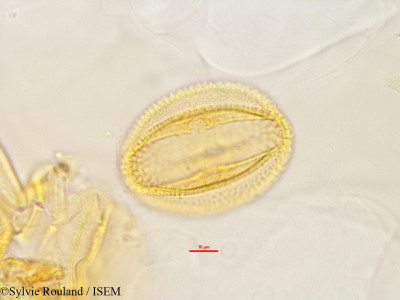 Raphidocystis sakalavensis - lame n° 2846